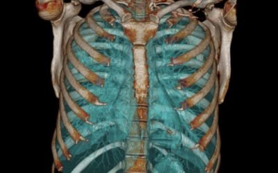 ACIDOSIS RESPIRATORIA Y BUCEO