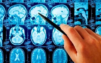 MANIFESTACIONES NEUROLOGICAS POSTINMERSION: ACTITUD PRACTICA