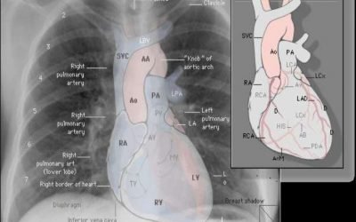 BIOQUIMICA AL EJERCICIO E INTERCAMBIO PULMONAR DE GASES DESPUES DE UNA INMERSION PROFUNDA A SATURACION