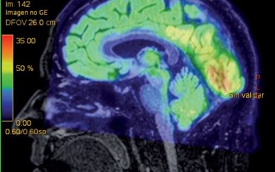 DESCOMPRESIÓN VESTIBULAR Y HELIOX