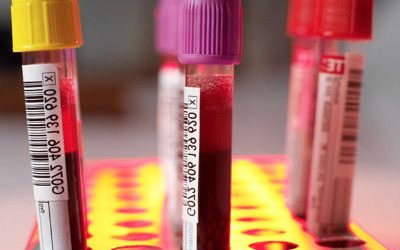 PATOLOGIA NEUROLOGICA DESCOMPRESIVA, Y SU RELACION CON EL VALOR DE HEMATOCRITO
