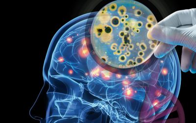 LOS NIVELES DE PROTEINAS SERICAS NSE Y S100B PODRIAN SER UTILIZADOS COMO INDICADORES A UN DIAGNOSTICO CLINICO DE DISBARISMOS DESCOMPRESIVOS NEUROLOGICOS Y PREDICTORES DE UNA POSIBLE RECUPERACION INCOMPLETA